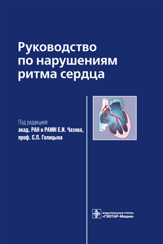 Руководство по нарушениям ритма сердца