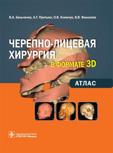 Черепно-лицевая хирургия в формате 3D