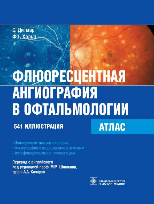 Флюоресцентная ангиография в офтальмологии