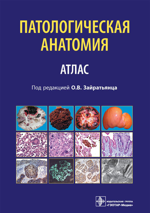 Патологическая анатомия. Учебное пособие