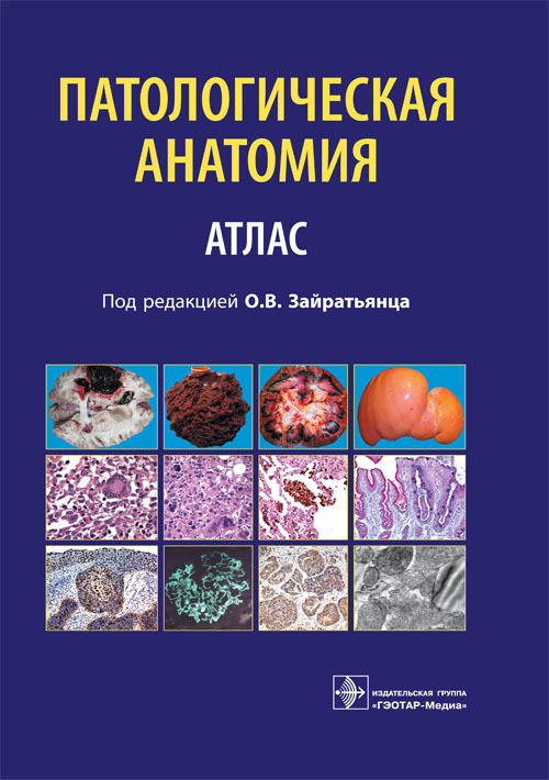 Патологическая анатомия. Учебное пособие
