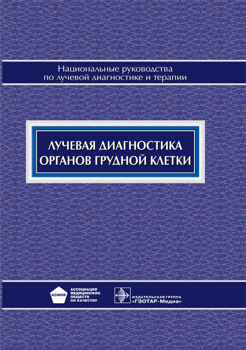 Лучевая диагностика органов грудной клетки. Национальные руководства по лучевой диагностике и терапии