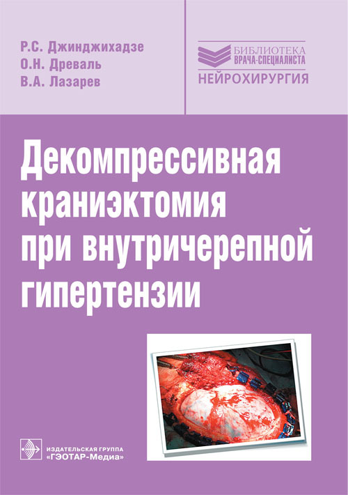 Декомпрессивная краниэктомия при внутричерепной гипертензии
