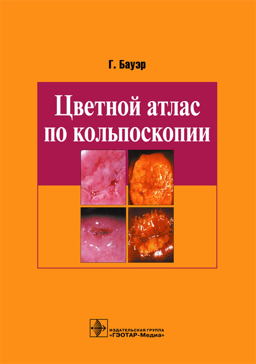 Цветной атлас по кольпоскопии