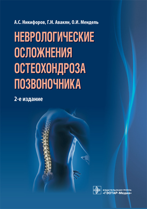 Неврологические осложнения остеохондроза позвоночника