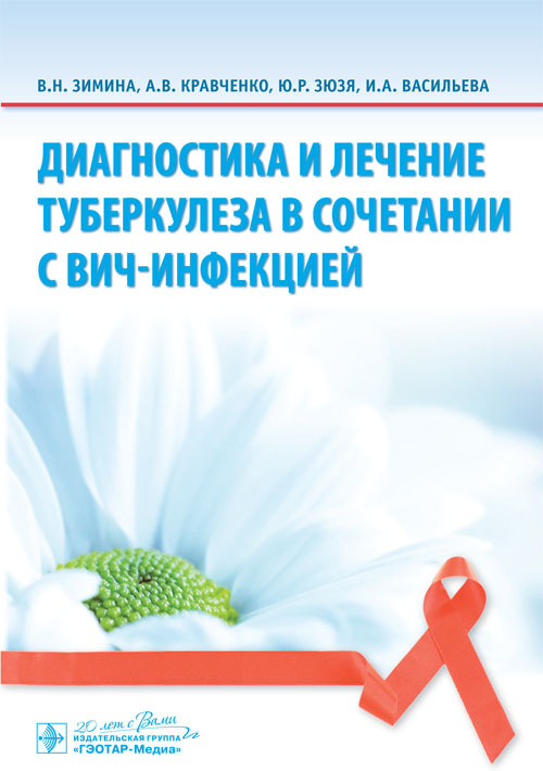 Диагностика и лечение туберкулеза в сочетании с ВИЧ-инфекцией