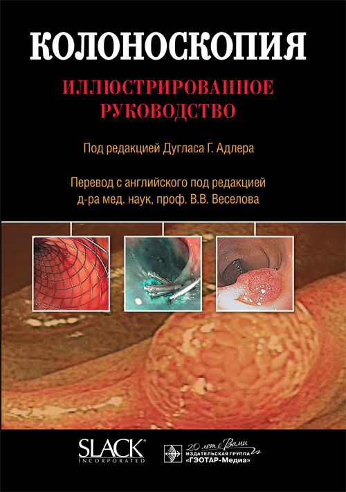 Колоноскопия. Иллюстрированное руководство