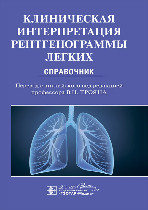Клиническая интерпретация рентгенограммы легких. Справочник