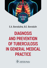 Diagnosis and prevention of tuberculosis in general medical practice. Tutorial guide