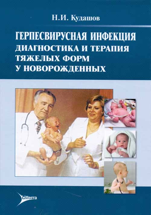 Герпесвирусная инфекция. Диагностика и терапия тяжелых форм у новорожденных. Монография